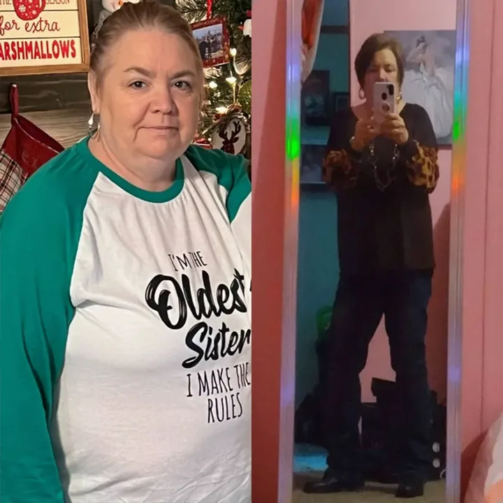 Marlene before and after